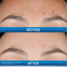 CeraVe Resurfacing Retinol Serum 30ml